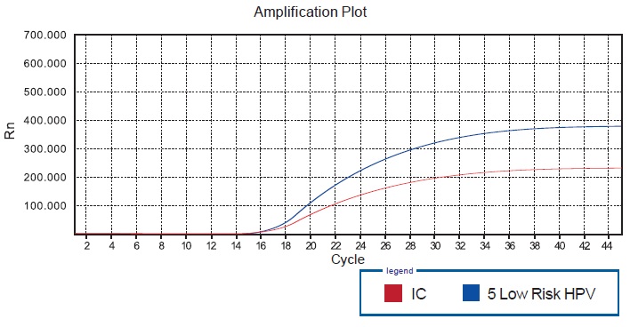 5 Low-risk HPV Real-time PCR Kit, Hybribio, HybriMax, Amplification