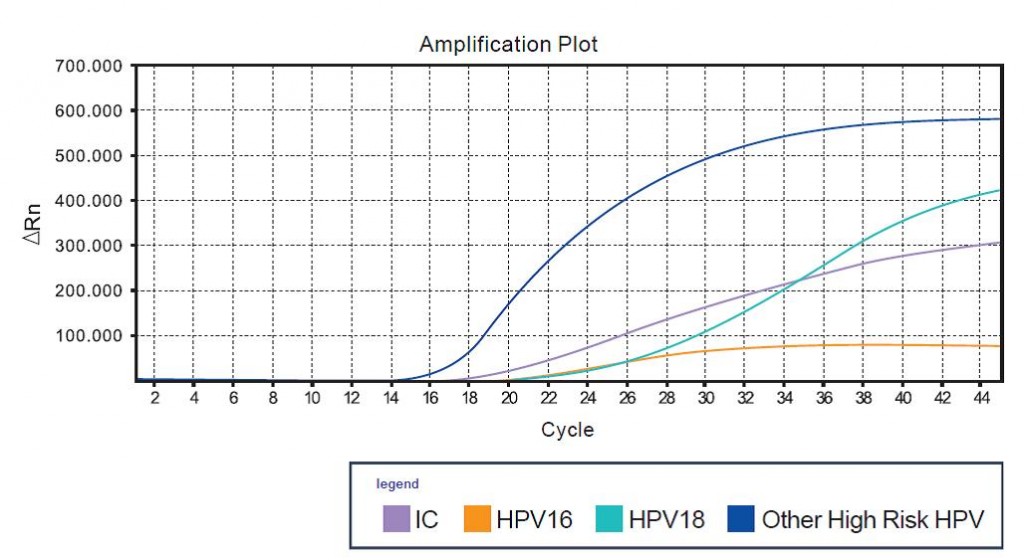 Amplification HPV, HybriMax, Hybribio